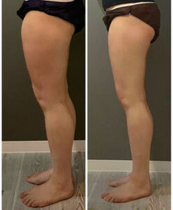 【1ヶ月で脚やせ】プロが「可能です」と断言する理由｜-5cmも夢じゃない”見た目激変”メソッド