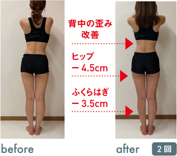 体の歪みが改善されました。あきらめなくてよかった！