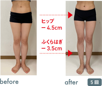 エステと筋膜リリースの 組み合わせが最高！