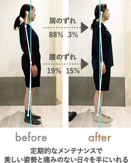 前傾姿勢・スタイルの改善