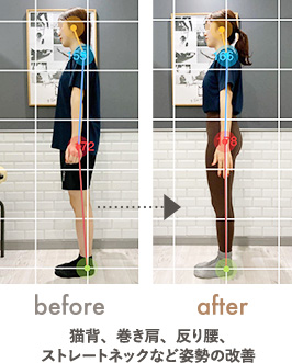 猫背・スマホ首の改善