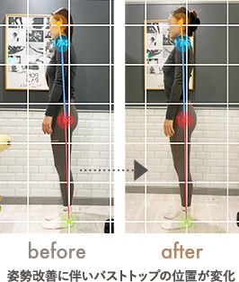 姿勢改善によるボディラインの変化