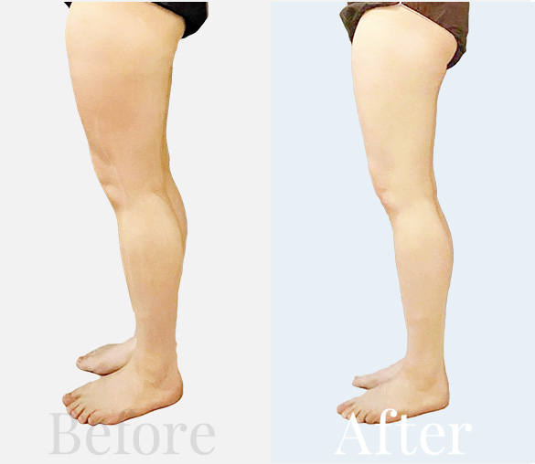 Before / After