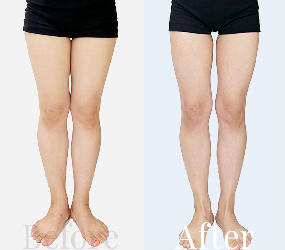 Before / After