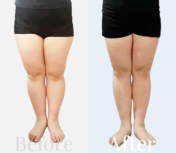 Before / After