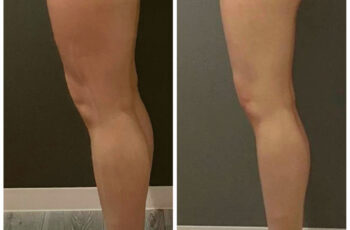 【1ヶ月で脚やせ】プロが「可能です」と断言する理由｜-5cmも夢じゃない”見た目激変”メソッド