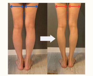 1ヶ月で脚痩せ！見た目を変えるトレーニングと食事