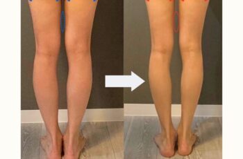 1ヶ月で脚痩せ！見た目を変えるトレーニングと食事