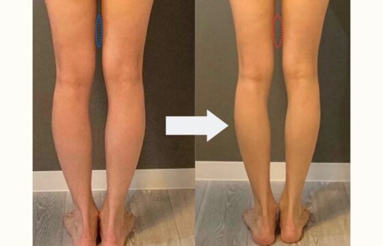 1ヶ月で脚痩せ！見た目を変えるトレーニングと食事